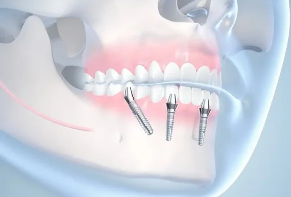 Dental-pic-3